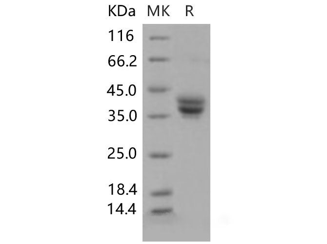 Recombinant Mouse GPA33/Glycoprotein A33 Protein (His Tag)