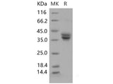 Recombinant Mouse GPA33/Glycoprotein A33 Protein (His Tag)