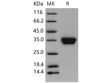 Recombinant Mouse ASAM Protein (His Tag)(Active)