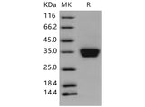 Recombinant Mouse ASAM Protein (His Tag)(Active)
