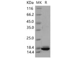 Recombinant Mouse Peroxiredoxin 5/PRDX5 Protein (His Tag)(Active)