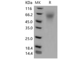 Recombinant Mouse LYPD3 Protein (His Tag)(Active)
