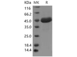 Recombinant Mouse SPARCL1/SPARC-like 1 Protein (His Tag)