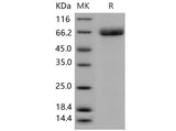 Recombinant Mouse Acetylcholinesterase/ACHE Protein (His Tag)(Active)