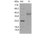 Recombinant Mouse TGFBR3/Betaglycan Protein (His Tag)