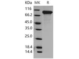 Recombinant Mouse DDR2 Kinase/CD167b Protein (His Tag)(Active)