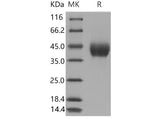 Recombinant Mouse Factor D Protein (aa 1-258, His Tag)