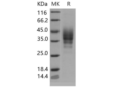 Recombinant Mouse CD2 Protein (His Tag)