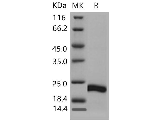 Recombinant Mouse CSRP1 Protein (His Tag)