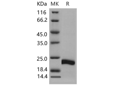 Recombinant Mouse CSRP1 Protein (His Tag)