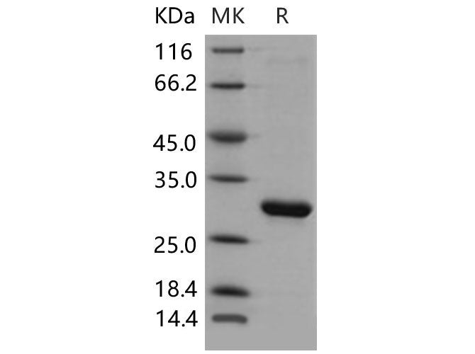 Recombinant Mouse HPGD/15-PGDH Protein (His Tag)(Active)