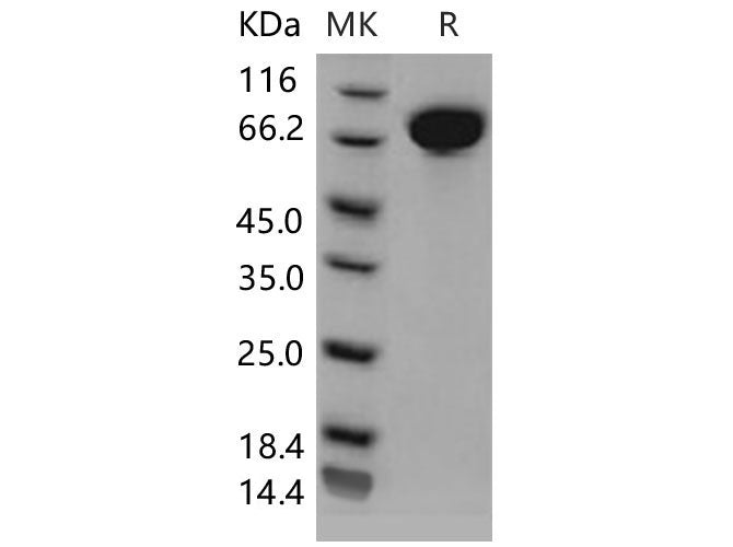 Recombinant Mouse c-kit/CD117 Protein (His Tag)(Active)