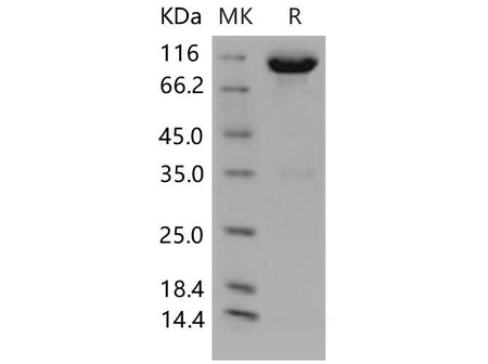 Recombinant Mouse c-kit/CD117 Protein (Fc Tag)(Active)