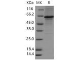 Recombinant Mouse METAP2 Protein (His Tag)(Active)