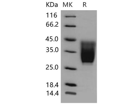Recombinant Mouse CD99L2 Protein (His Tag)(Active)