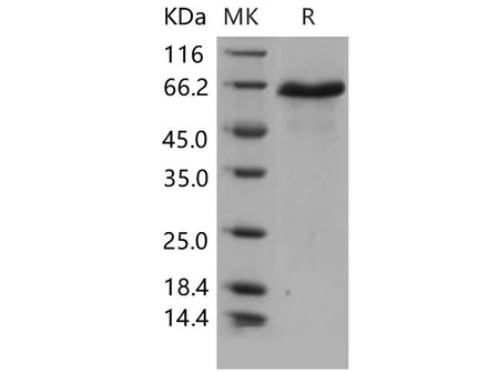 Recombinant Mouse DLL1/Delta-1 Protein (His Tag)(Active)