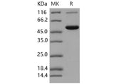 Recombinant Mouse Carboxylesterase-2/CES2 Protein (His Tag)(Active)