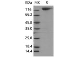 Recombinant Mouse MERTK/MER Protein (Fc Tag)