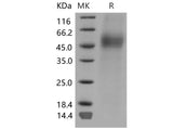 Recombinant Mouse CD19/Leu-12 Protein (His Tag)