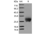 Recombinant Mouse CTLA4/CD152 Protein (His Tag)(Active)