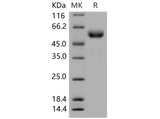 Recombinant Mouse CTLA4/CD152 Protein (Fc Tag)