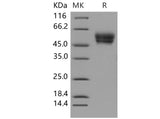 Recombinant Mouse CADM4/IGSF4C/TSLL2 Protein (His Tag)