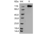 Recombinant Mouse OSMR/IL-31RB Protein (His Tag)