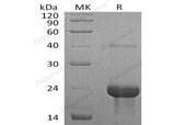Recombinant Mouse TNFR1/TNFRSF1A Protein (His Tag)(Active) - MSE Supplies LLC