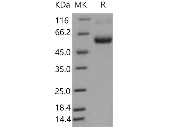 Recombinant Mouse TNFR1/TNFRSF1A Protein (Fc Tag)(Active)