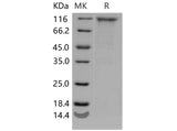 Recombinant Mouse CD180/RP105/LY64 Protein (Fc Tag)