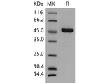 Recombinant Mouse AGER/RAGE Protein (His Tag)(Active)