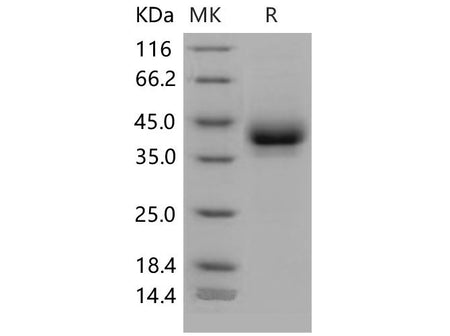 Recombinant Mouse CD209B/DC-SIGNR1 Protein (His Tag)