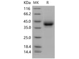 Recombinant Mouse CD209B/DC-SIGNR1 Protein (His Tag)