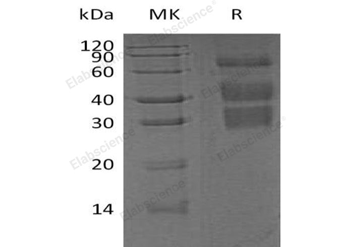 Recombinant Mouse Clusterin/ApoJ Protein (His Tag)