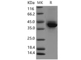 Recombinant Mouse S100A4 Protein (Fc Tag)