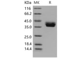 Recombinant Mouse CADM3 Protein (His Tag)