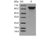 Recombinant Mouse Kininogen-1/KNG1 Protein (His Tag)(Active)