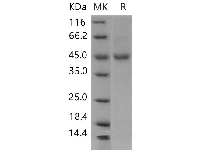 Recombinant Mouse ENTPD5 Protein (His Tag)(Active)