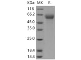 Recombinant Mouse IFNAR1/IFNAR Protein (His Tag)(Active)