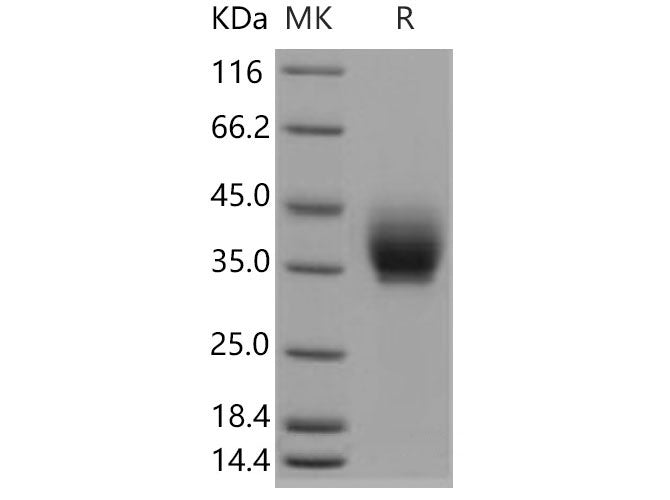 Recombinant Mouse ICOS/AILIM Protein (Fc Tag)