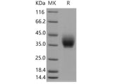 Recombinant Mouse ICOS/AILIM Protein (Fc Tag)