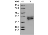 Recombinant Mouse JAM3/JAM-C Protein (His Tag)