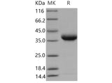 Recombinant Mouse JAM2/CD322 Protein (His Tag)(Active)