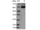 Recombinant Mouse SHP2/PTPN11 Protein (His Tag)(Active)