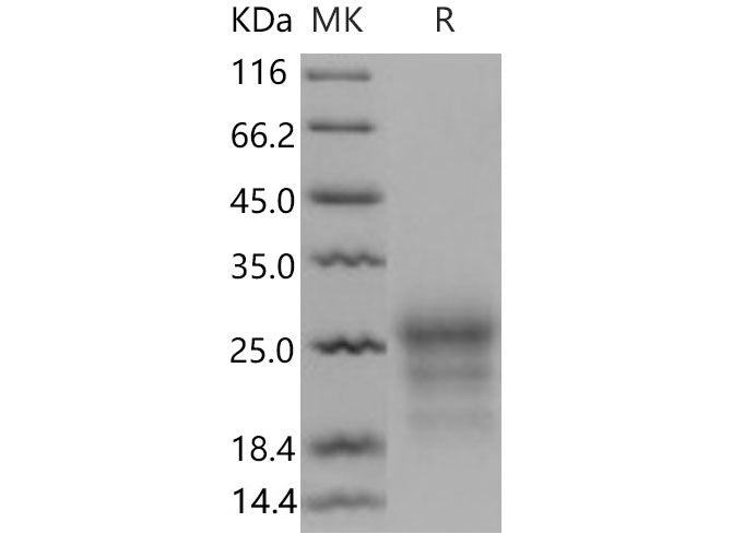 Recombinant Mouse CD90/THY-1 Protein (His Tag)