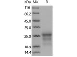 Recombinant Mouse CD90/THY-1 Protein (His Tag)