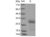 Recombinant Mouse IGFBP6/IBP-6 Protein (His Tag)(Active)
