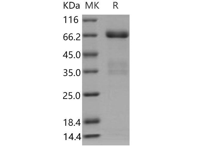 Recombinant Mouse PRLR/Prolactin Receptor Protein (His & Fc Tag)