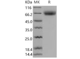 Recombinant Mouse Osteomodulin/OMD Protein (His Tag)
