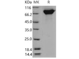 Recombinant Mouse Periostin/POSTN Protein (His Tag)(Active)